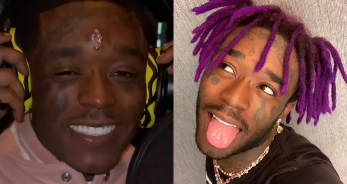 6.7億巨鑽又鑲回額頭！ 28天前才傷口感染 Lil Uzi Vert 令網友全傻眼